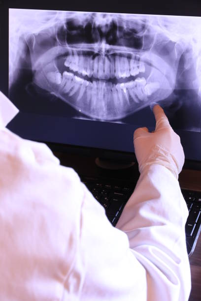 Best Emergency Root Canal Treatment in Woodmoor, CO